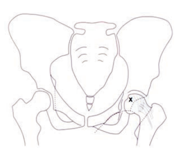 Ilustracja do pytania 362