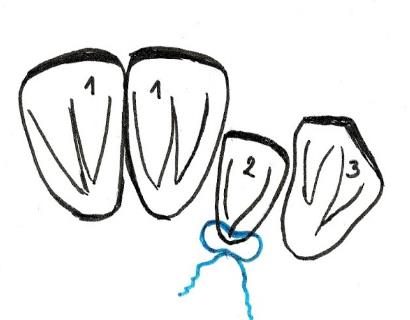 Ilustracja do pytania 456