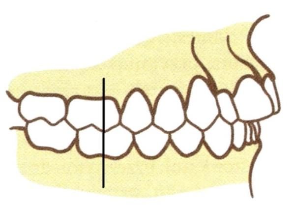 Ilustracja do pytania 18