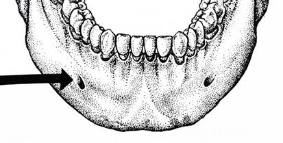 Ilustracja do pytania 173