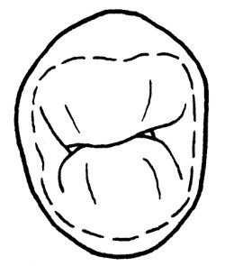Ilustracja do pytania 5