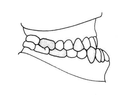 Ilustracja do pytania 381
